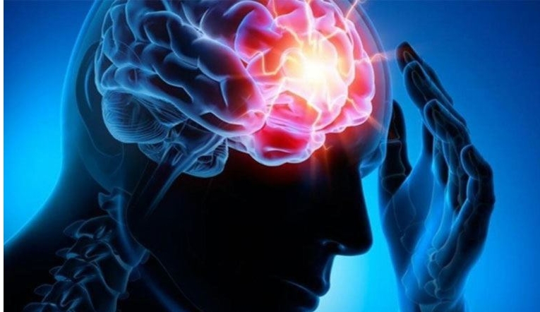 Epilepsi farkındalığı için bilgilendirme broşürü
